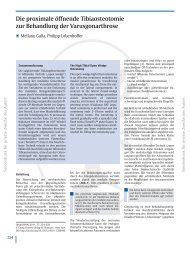 Osteotomie an der Tibia - sportsclinic Germany