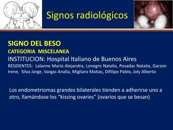 Signo del beso - Congreso SORDIC