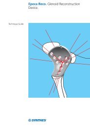 Epoca Reco. Glenoid Reconstruction Device.