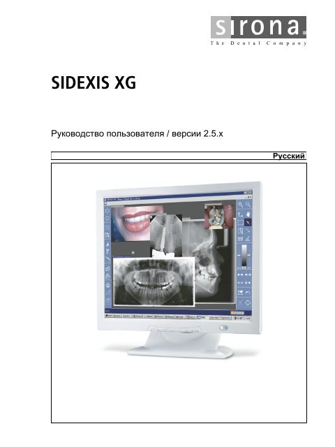 SIDEXIS XG