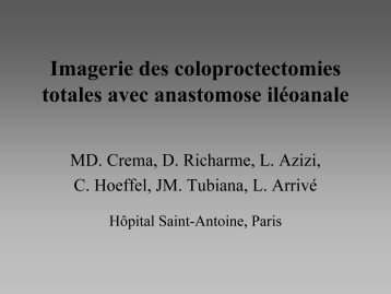 Imagerie des coloproctectomies totales avec anastomose ilÃ©oanale