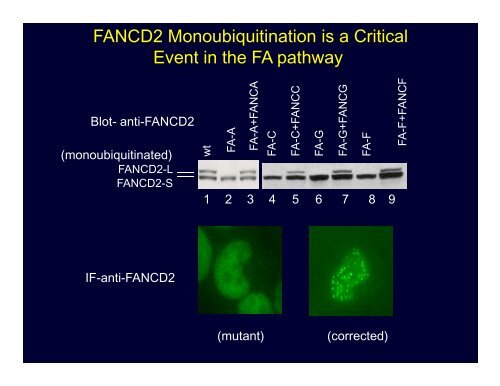 Fanconi Anemia: Diagnosis and Treatment