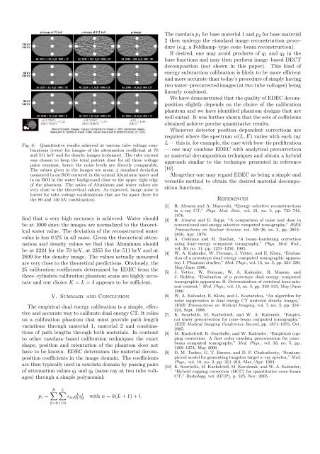 Empirical Dual Energy Calibration (EDEC) for Cone-Beam ...