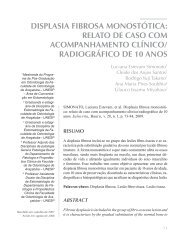 DISPLASIA FIBROSA MONOSTÃTICA: RELATO DE CASO ... - USC