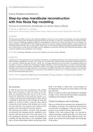 Step-by-step mandibular reconstruction with free fibula flap modelling