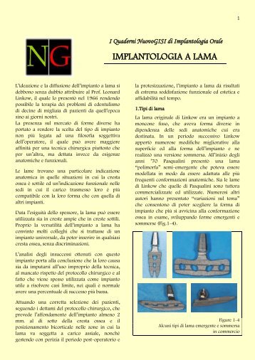 IMPLANTOLOGIA A LAMA - Dentistaitaliano.it