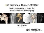 Die proximale Humerusfraktur