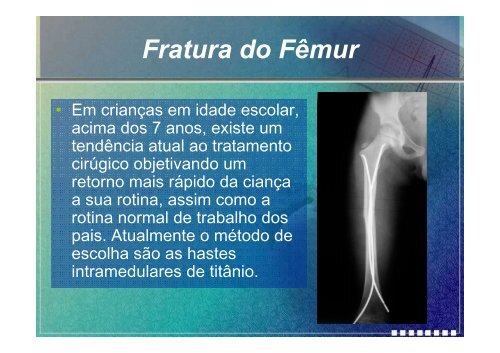 Fratura na InfÃ¢ncia.pdf