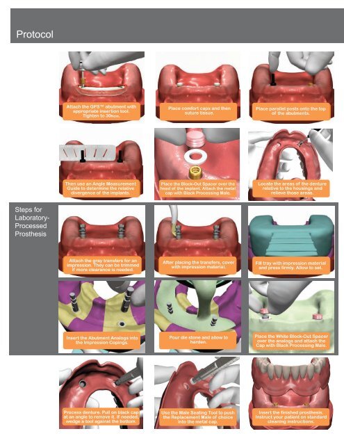 GPS™ Brochure - Implant Direct