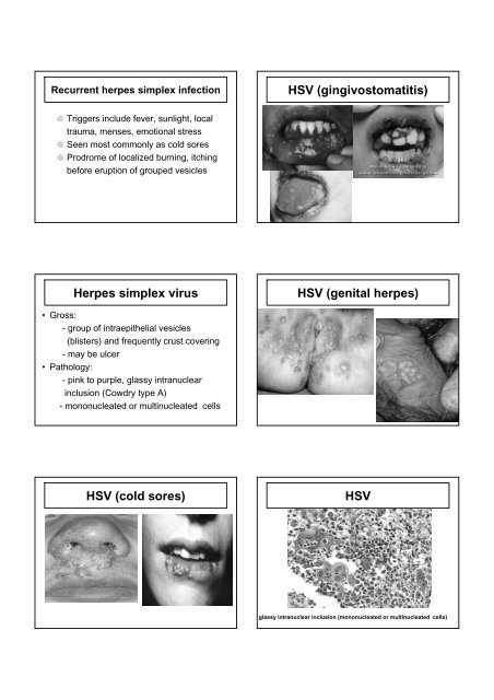 VIRAL INFECTION - Faculty of Medicine