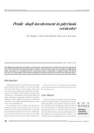Penile shaft involvement in pityriasis versicolor