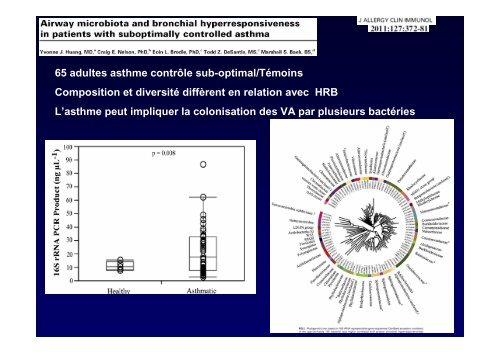 ComorbiditÃ©s dans l'asthme - Infections bactÃ©riennes