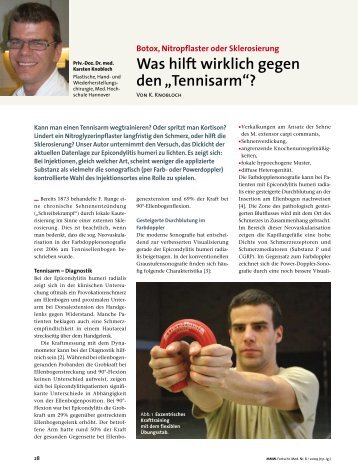 Therapie des Tennis-& Golferellenbogens - SportPraxis Knobloch