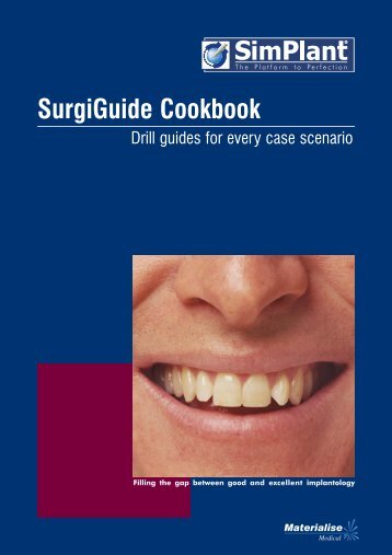 SurgiGuide Cookbook - Dental-Depot