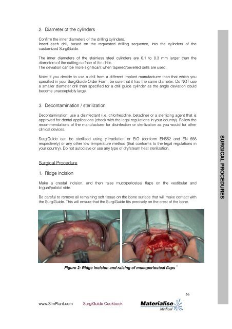 SurgiGuide Cookbook - Dental-Depot