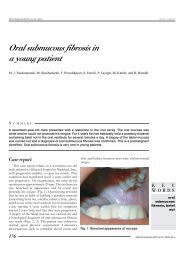 Oral submucous fibrosis in a young patient - ResearchGate