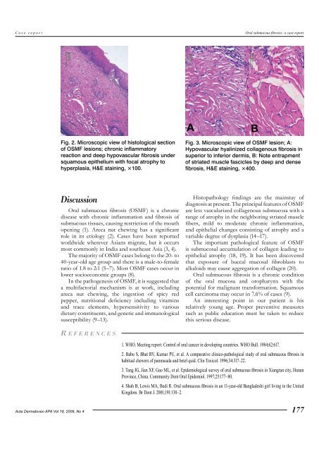 Oral submucous fibrosis in a young patient - ResearchGate