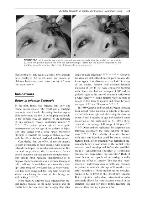 Chemodenervation of Extraocular Musclesâ Botulinum Toxin