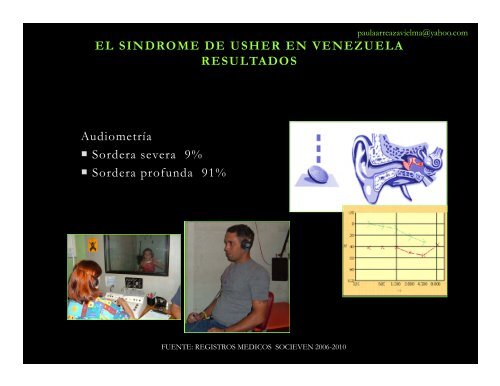 EL SINDROME DE USHER EN VENEZUELA - Deafblind International