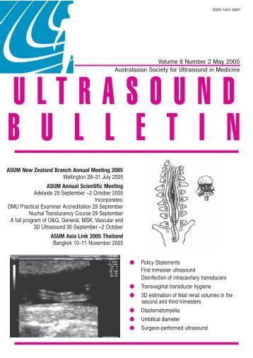 May 05.indd - Australasian Society for Ultrasound in Medicine