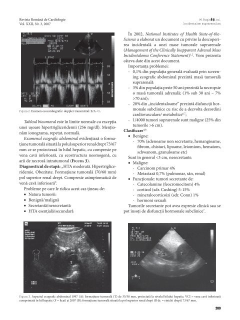 Ghidul pentru managementul hipertensiunii arteriale 2007 Grupul ...