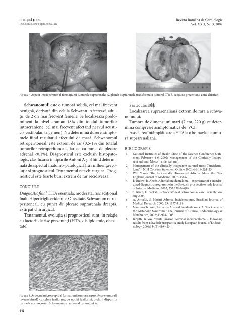 Ghidul pentru managementul hipertensiunii arteriale 2007 Grupul ...