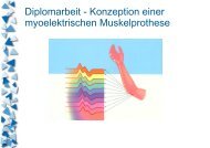 Diplomarbeit - Konzeption einer myoelektrischen Muskelprothese