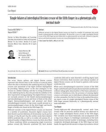 Single bilateral interdigital flexion crease of the fifth finger in a ...