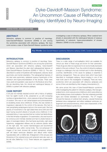 Dyke-Davidoff-Masson Syndrome: An Uncommon Cause of ... - JCDR