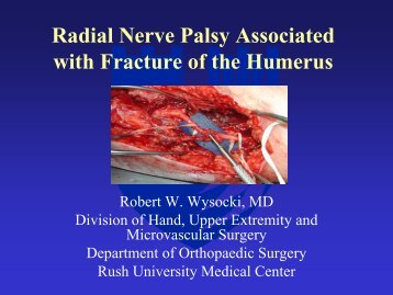 Radial Nerve Palsy Associated with Fracture of the Humerus