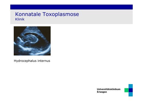 Konnatale Toxoplasmose - Dr. Leis.pdf - Frauenklinik