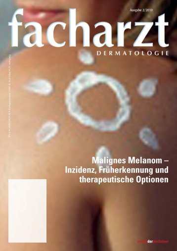 Malignes Melanom – Inzidenz, Früherkennung und therapeutische ...