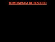 TOMOGRAFIA DE PESCOÃO - Comunidades