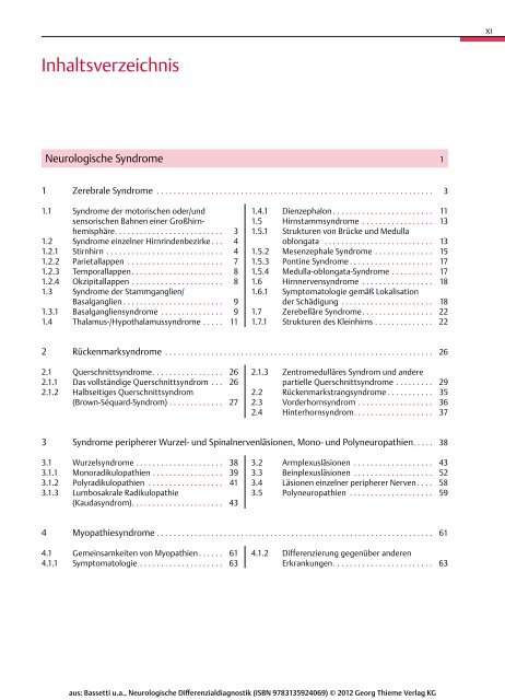 Thieme: Neurologische Differenzialdiagnostik