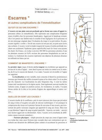 Les escarres et autres complications de l ... - Moteurline - APF