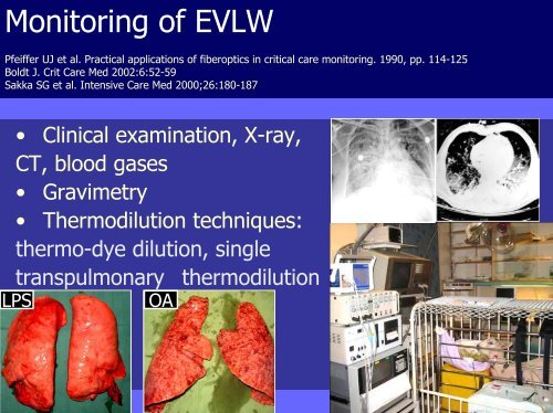 Sakka S et  al Chest 2002  - PULSION Medical Systems SE