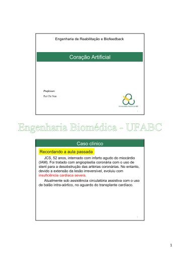 Coração artificial - Engenharia Biomédica