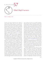 Chapter 57 Tibial Shaft Fractures