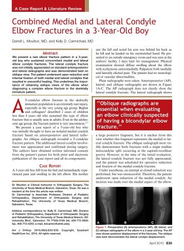 Combined Medial and Lateral Condyle Elbow Fractures in a 3-Year ...