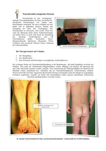 Neurodermitis (atopisches Ekzem) - Dr-triendl.at