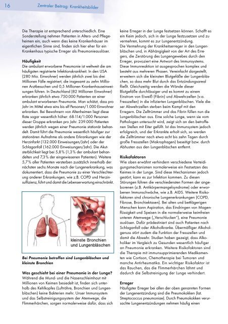 Ausgabe Herbst - 2005 - Patientenliga Atemwegserkrankungen e.V.