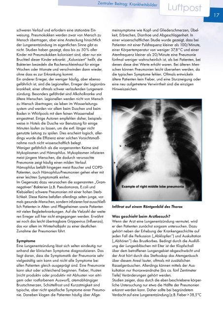 Ausgabe Herbst - 2005 - Patientenliga Atemwegserkrankungen e.V.