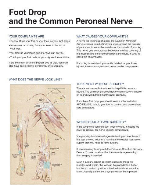 peroneal nerve foot drop