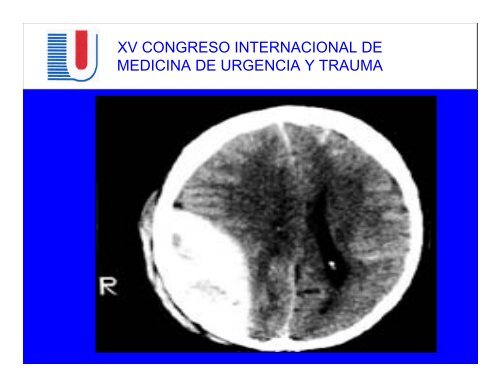 trauma craneoencefalico en el anciano - Reeme.arizona.edu