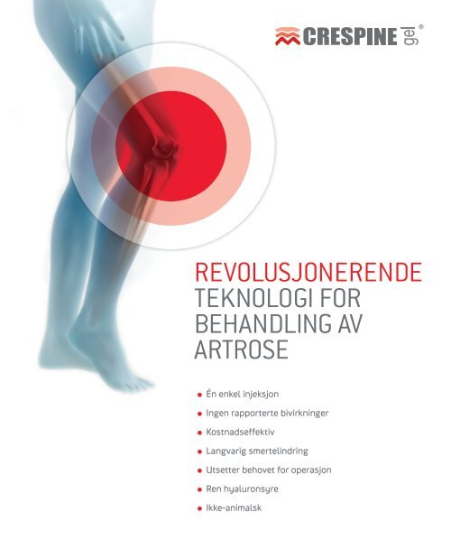 revolusjonerende teknologi for behandling av artrose - Crespine Gel