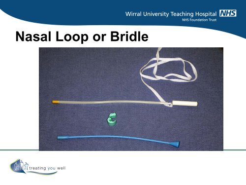 Enteral Nutrition Support Nasogastric feeding Tube