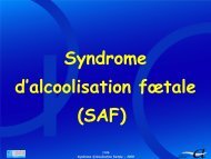 Syndrome d'alcoolisation fÅtale (SAF) - SFA