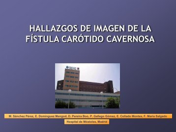 HALLAZGOS DE IMAGEN DE LA FÍSTULA CARÓTIDO CAVERNOSA