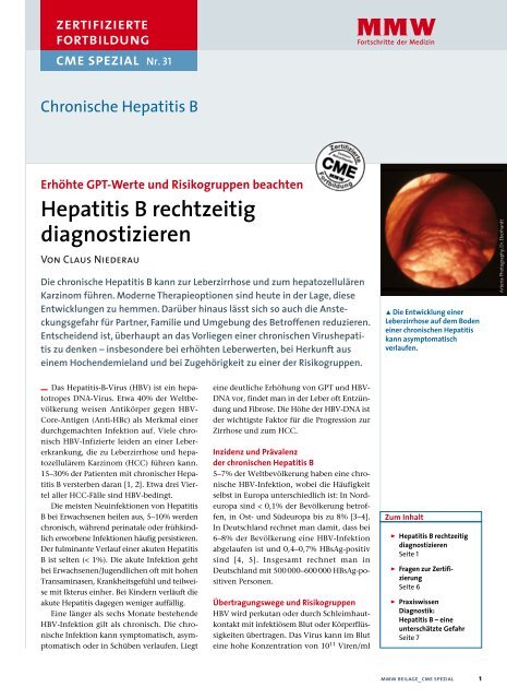 Diagnose Von Hepatitis B Und C Mta Schule Osnabra Ck