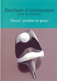 Prothèse de genou en OXINIUM pour patients jeunes - Dienst ...